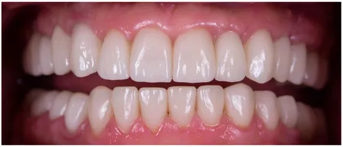 After dental treatment results